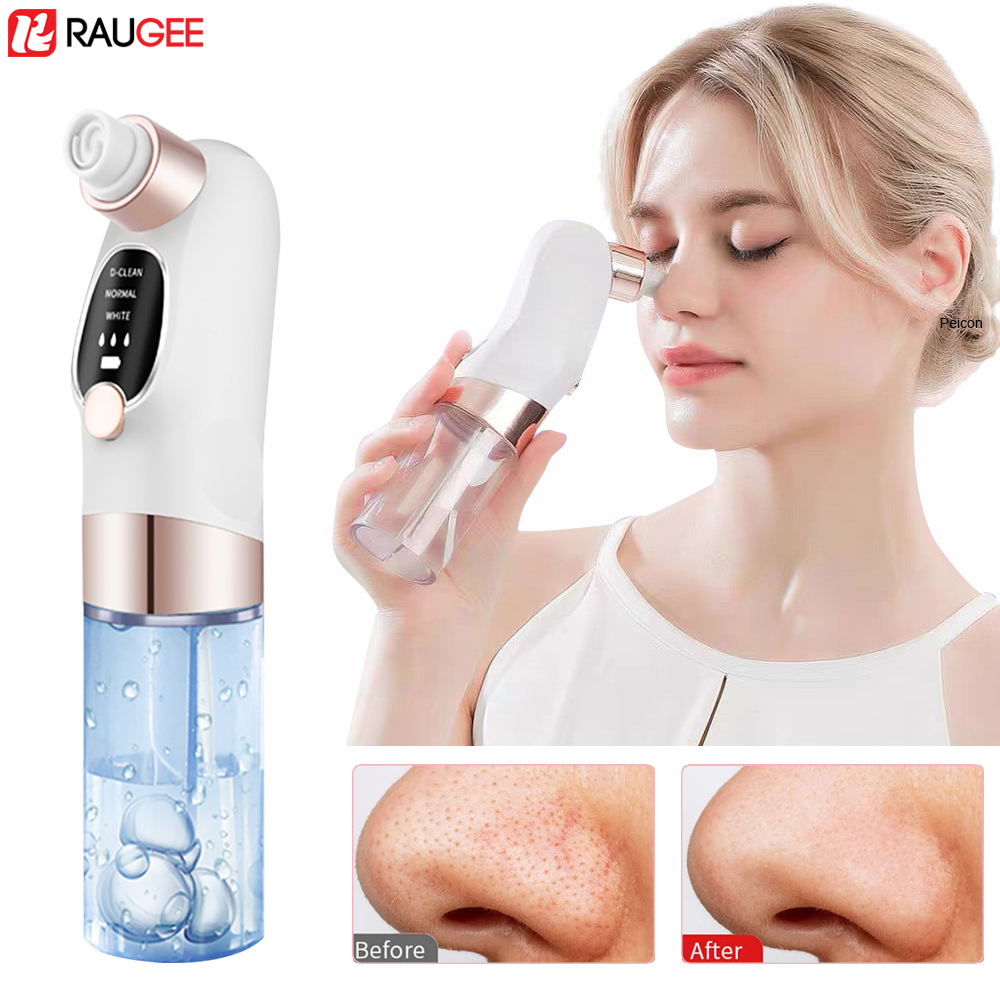 Blackhead Remover Electric Bla – Air Bubble Remover recenzja i cena